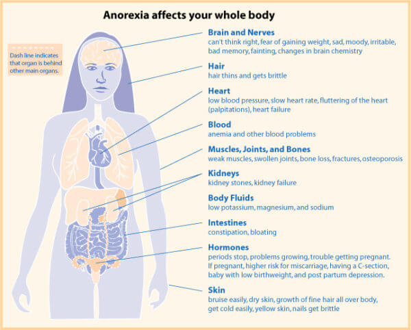 Anorexia Treatment Anorexia Nervosa Treatment Center Selah House