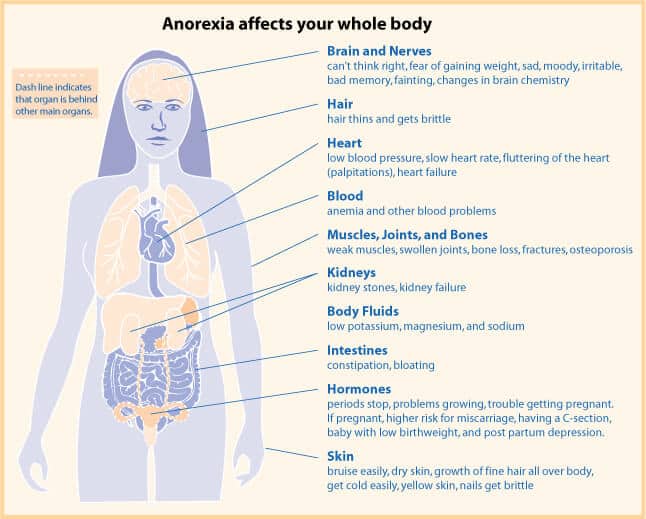 Anorexia Treatment | Anorexia Nervosa Treatment Center | Selah House